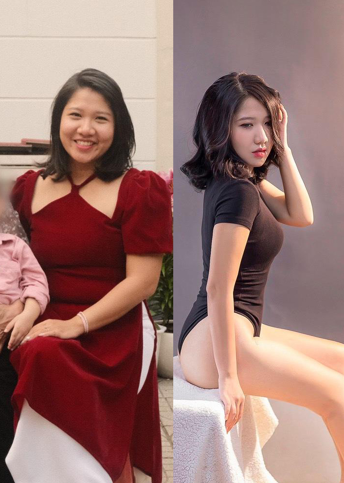 Trước vs Sau khi hút mỡ